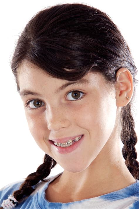 Girls Braces